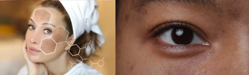 skin Anti-inflammatory and Antioxidant Properties