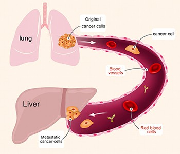 Tibżax Jekk Għandek Kanċer. Tgħallem Sempliċement Dawn l-4 Metodi Biex Inibix...